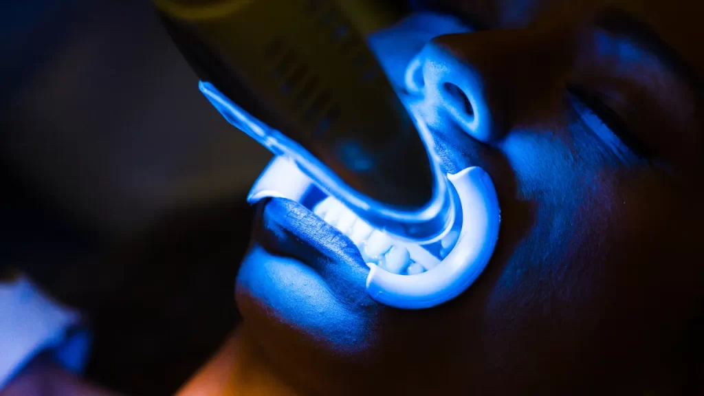 teeth whitening under blue light