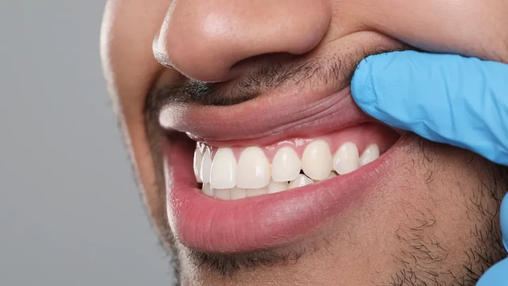 Man at the dentist checking his gums