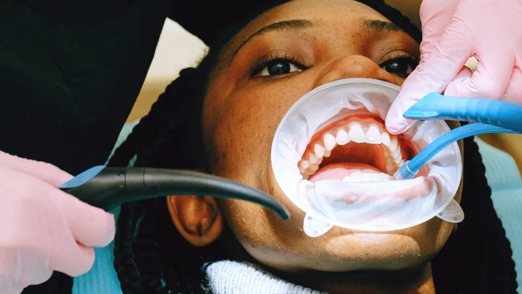 woman at the dentist with her mouth open